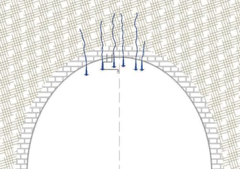 esquema de la intervención